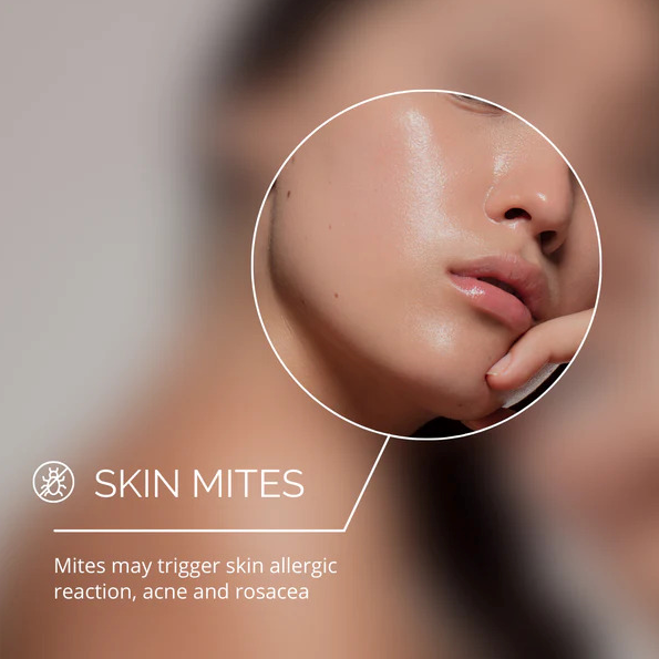 Can a High Frequency Wand Be Used on Active Breakouts?