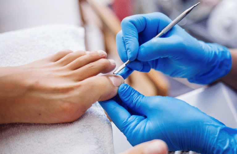 Best Ingrown Toenail Treatment in Singapore for Fast Relief