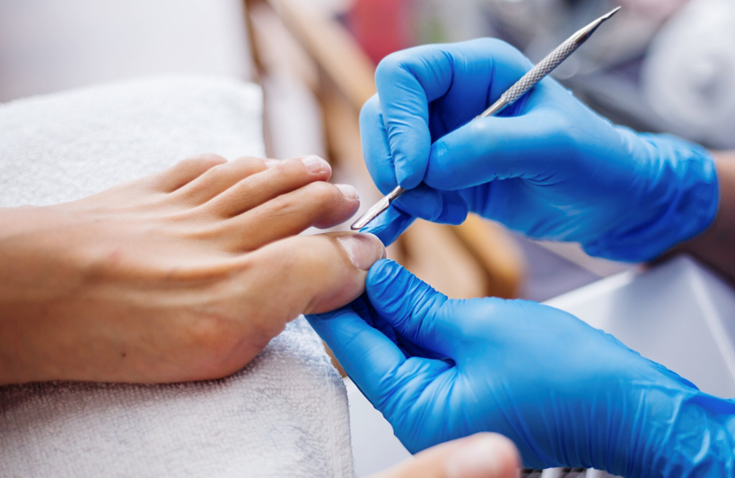 Best Ingrown Toenail Treatment in Singapore for Fast Relief