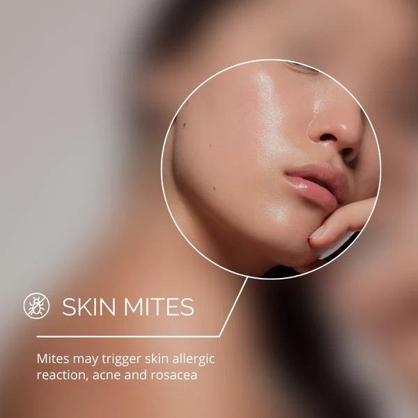 Active Breakouts